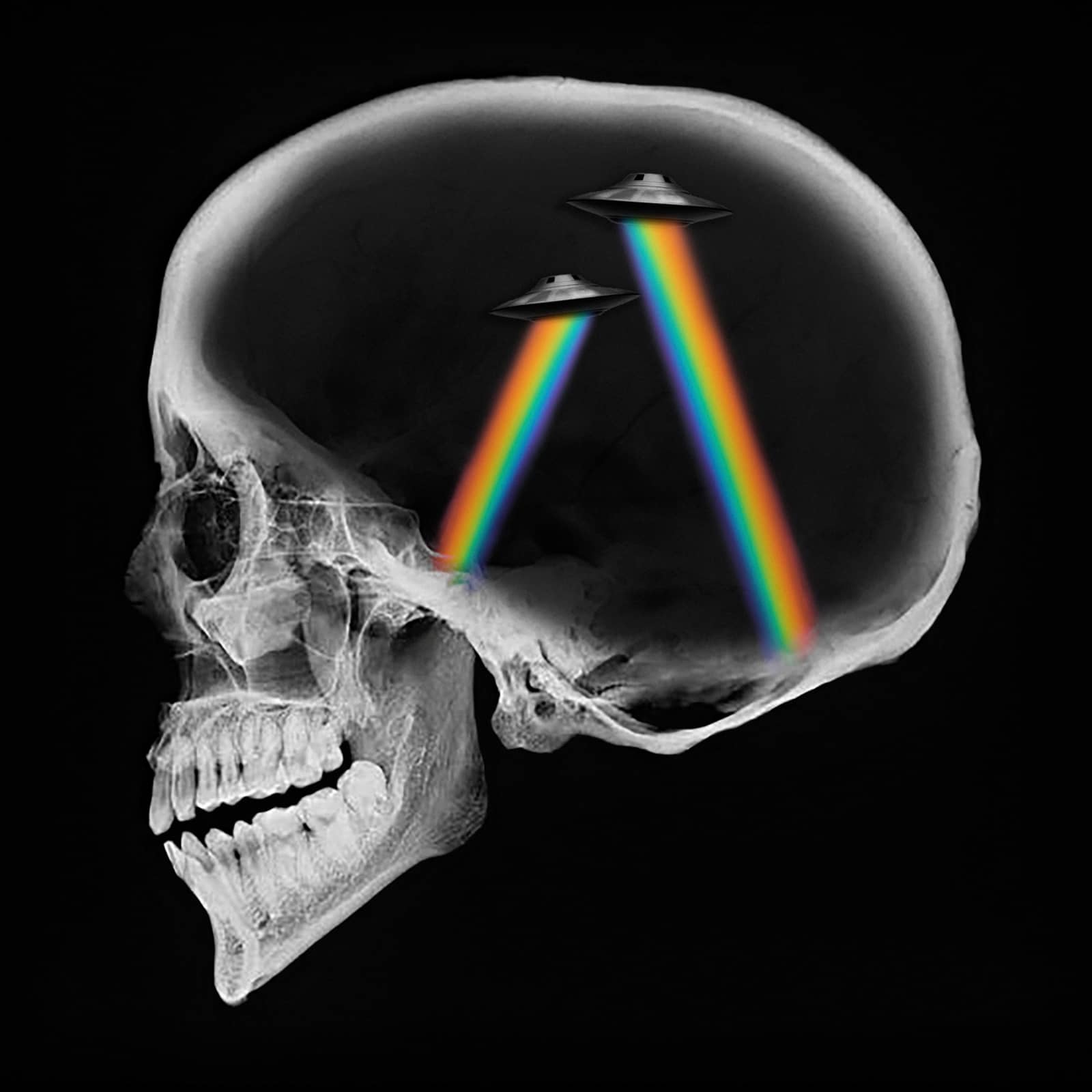 Axwell Ingrosso — Dreamer